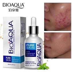💎💎Bioaqua 🤩  BioAqua Сыворотка от акне Pure Skin, 30 мл