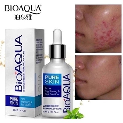 💎💎Bioaqua 🤩  BioAqua Сыворотка от акне Pure Skin, 30 мл