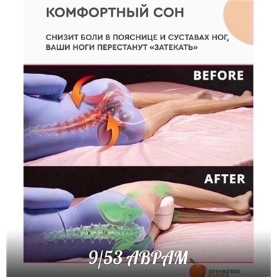 Подушка ортопедическая для ног 16.12.