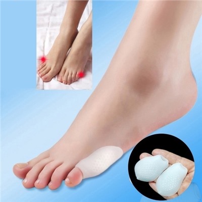 Bunion Hallux вальгус 06.01.